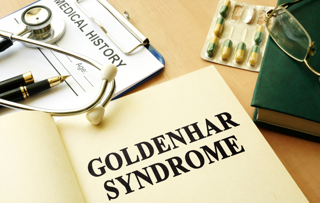 Síndrome de Goldenhar