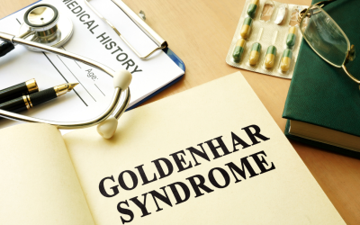 Síndrome de Goldenhar