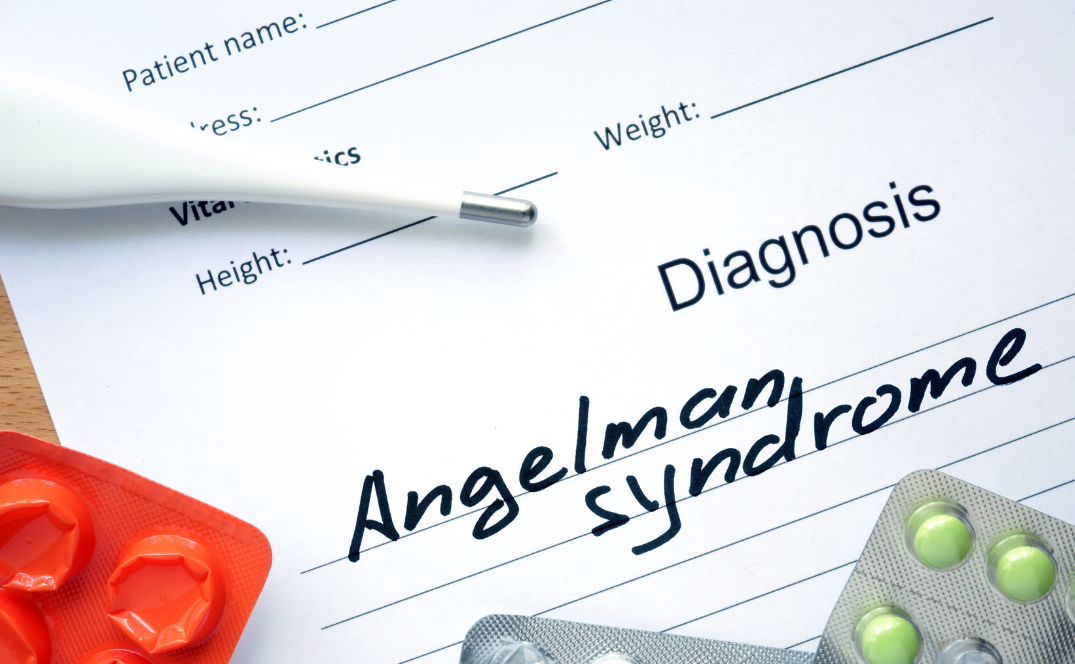 SÍNDROME DE ANGELMAN
